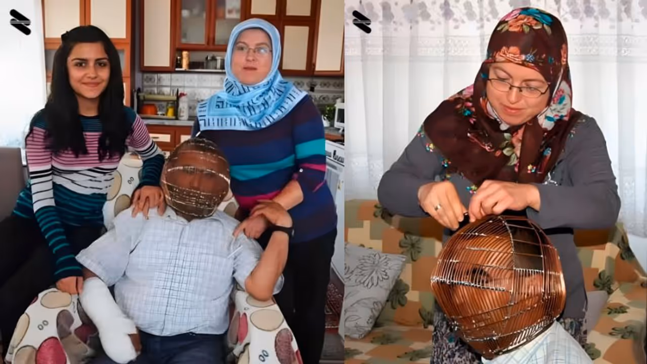 Turkey Mans Unique Attempts To Forget Smoking Habit viral