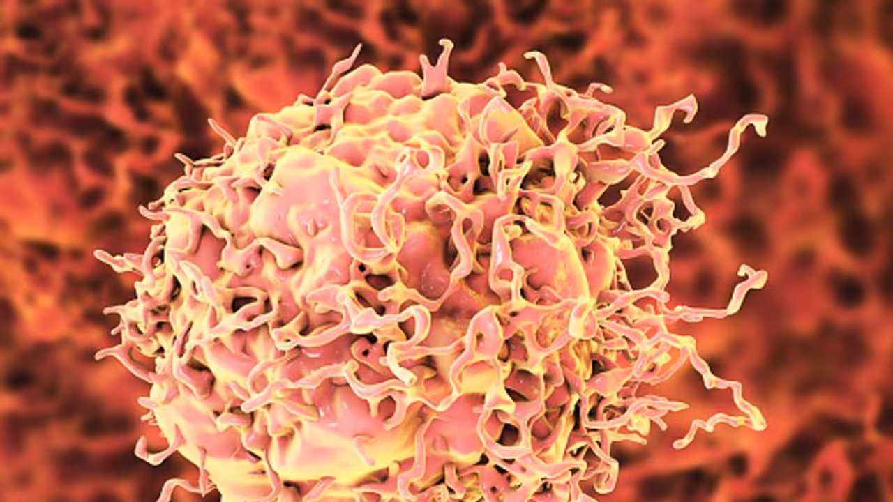 colon cancer colon cancer