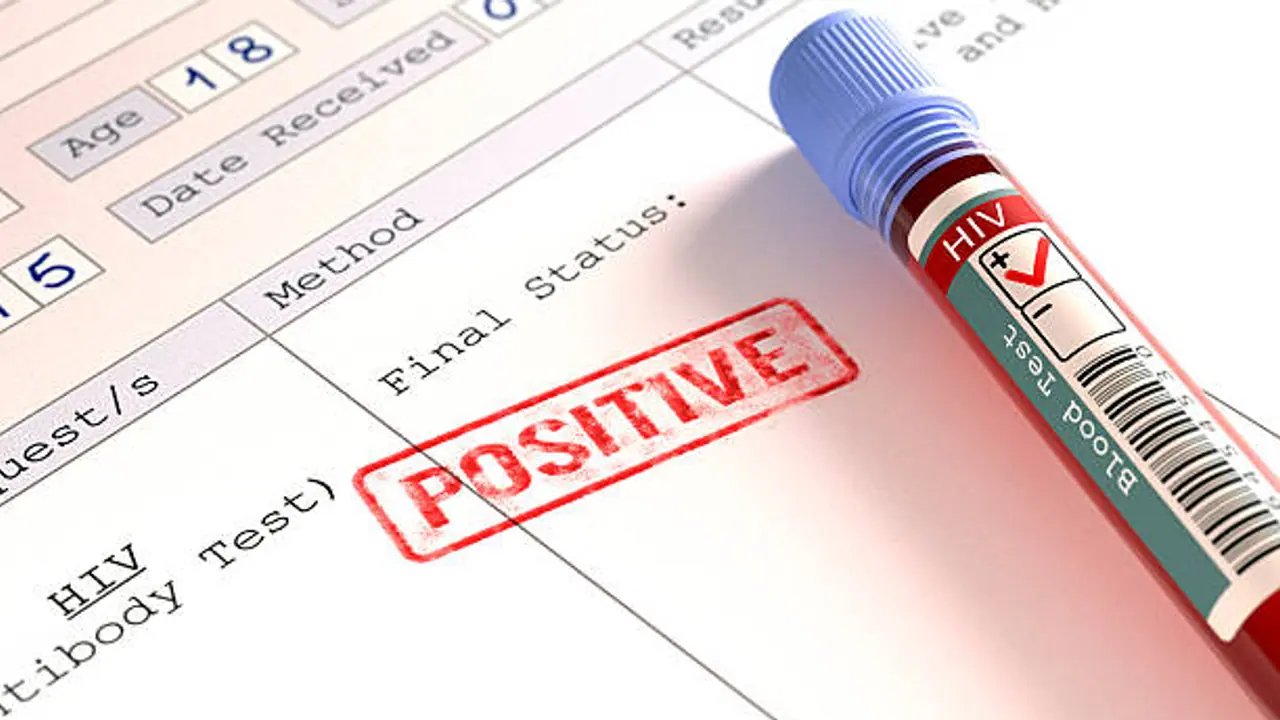 HIV Positive HIV Positive