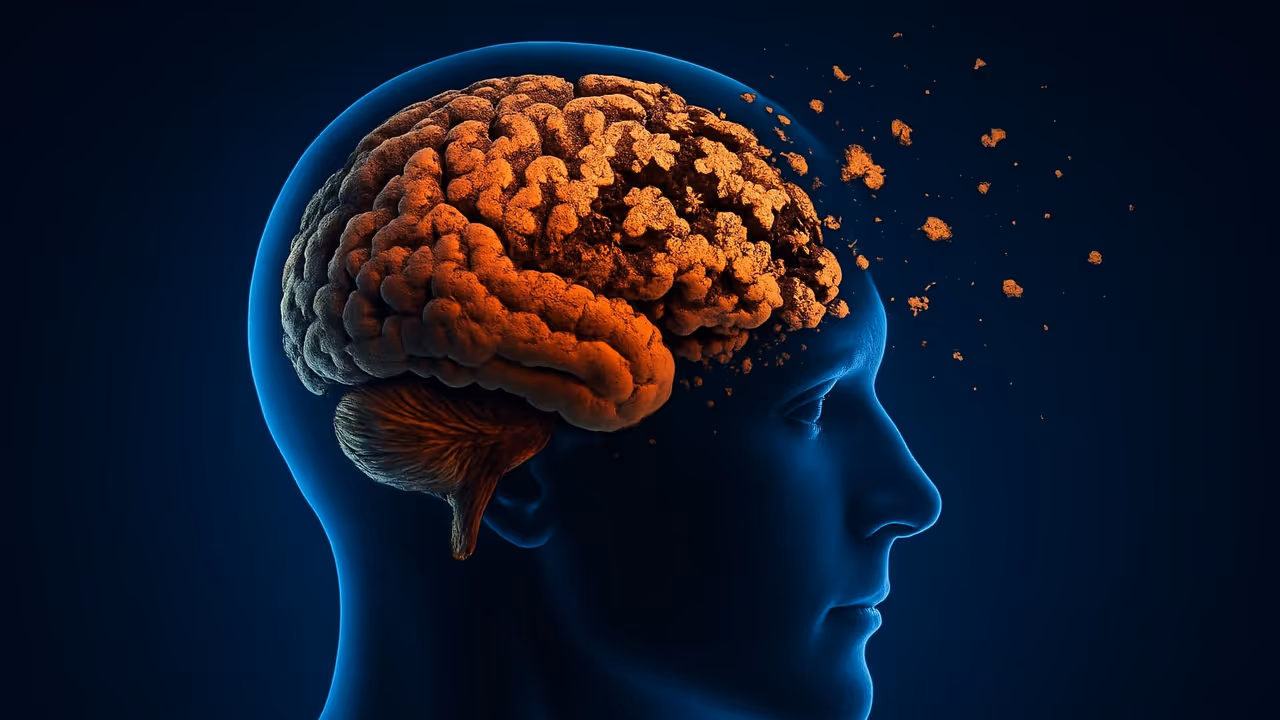 alzheimer's alzheimer's