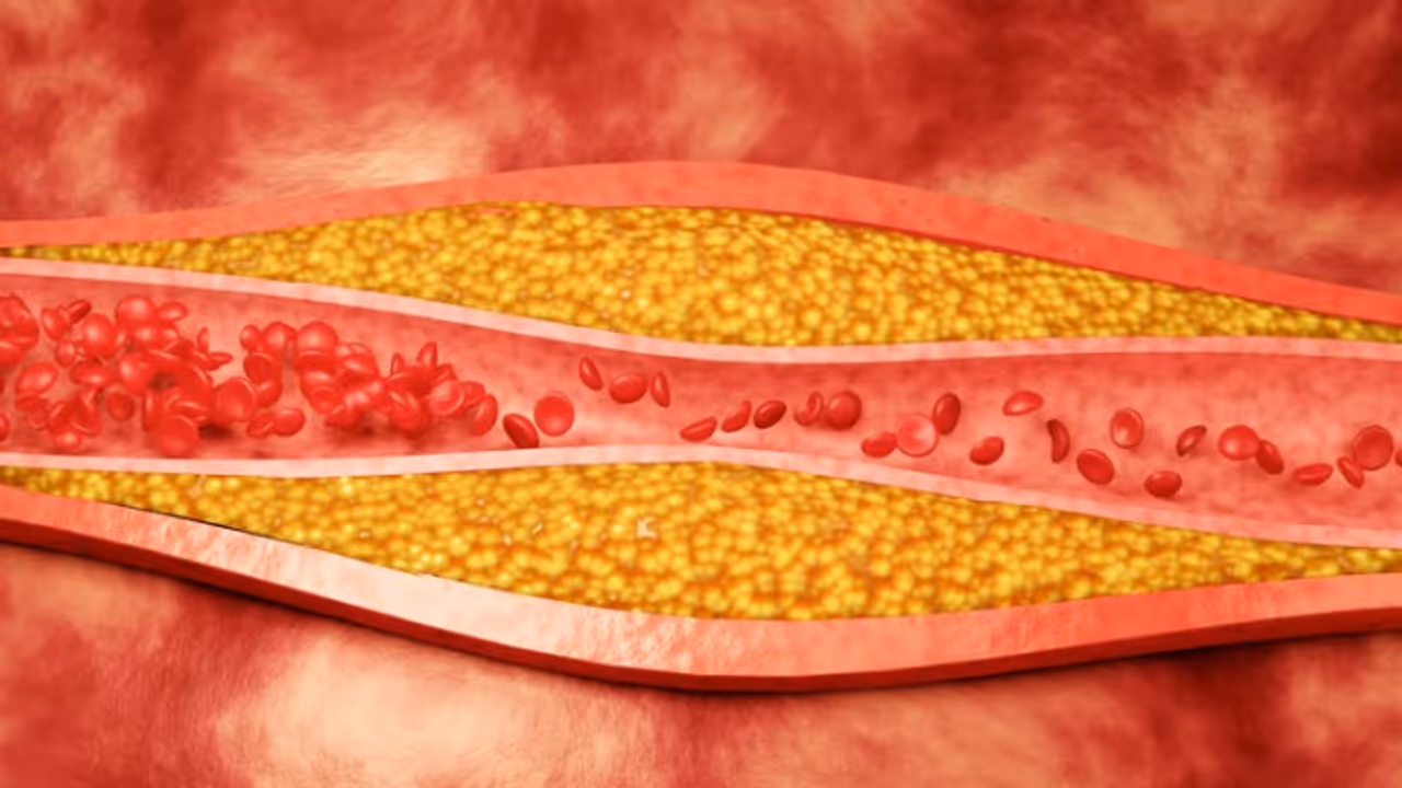 cholesterol cholesterol