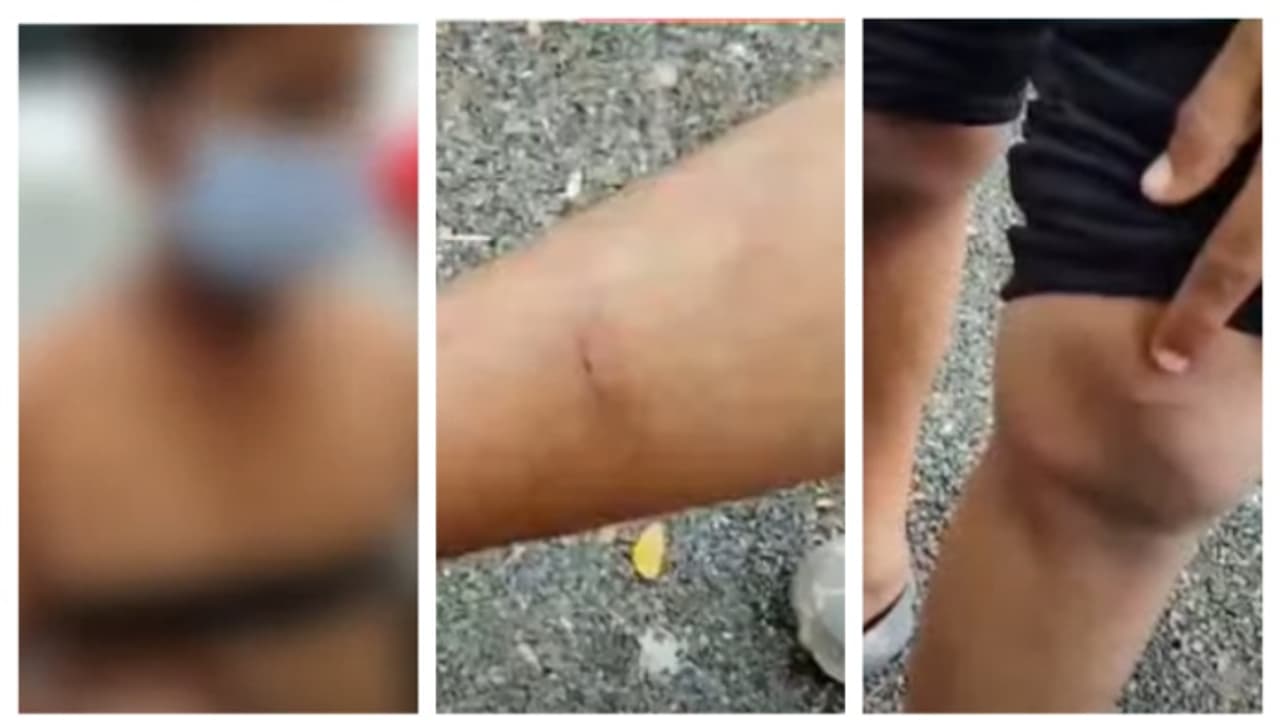 child attack child attack