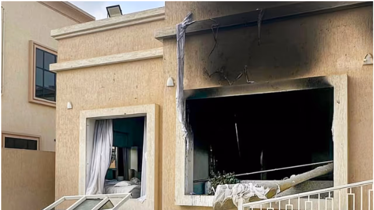 man suffers burns in villa fire 