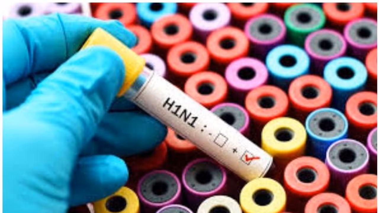 h1n1 h1n1