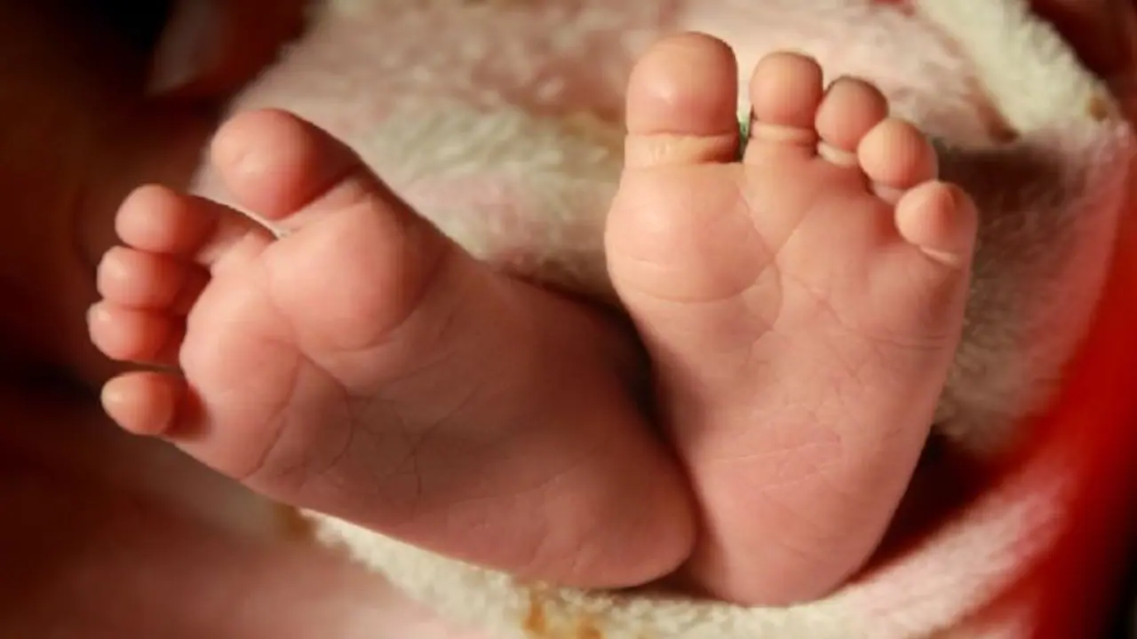 A child with four limbs was born it happened 10 minutes later A child with four limbs was born it happened 10 minutes later