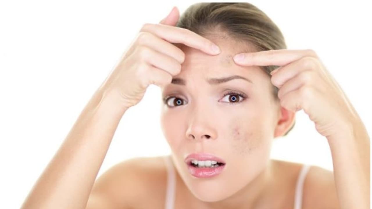 black spots black spots