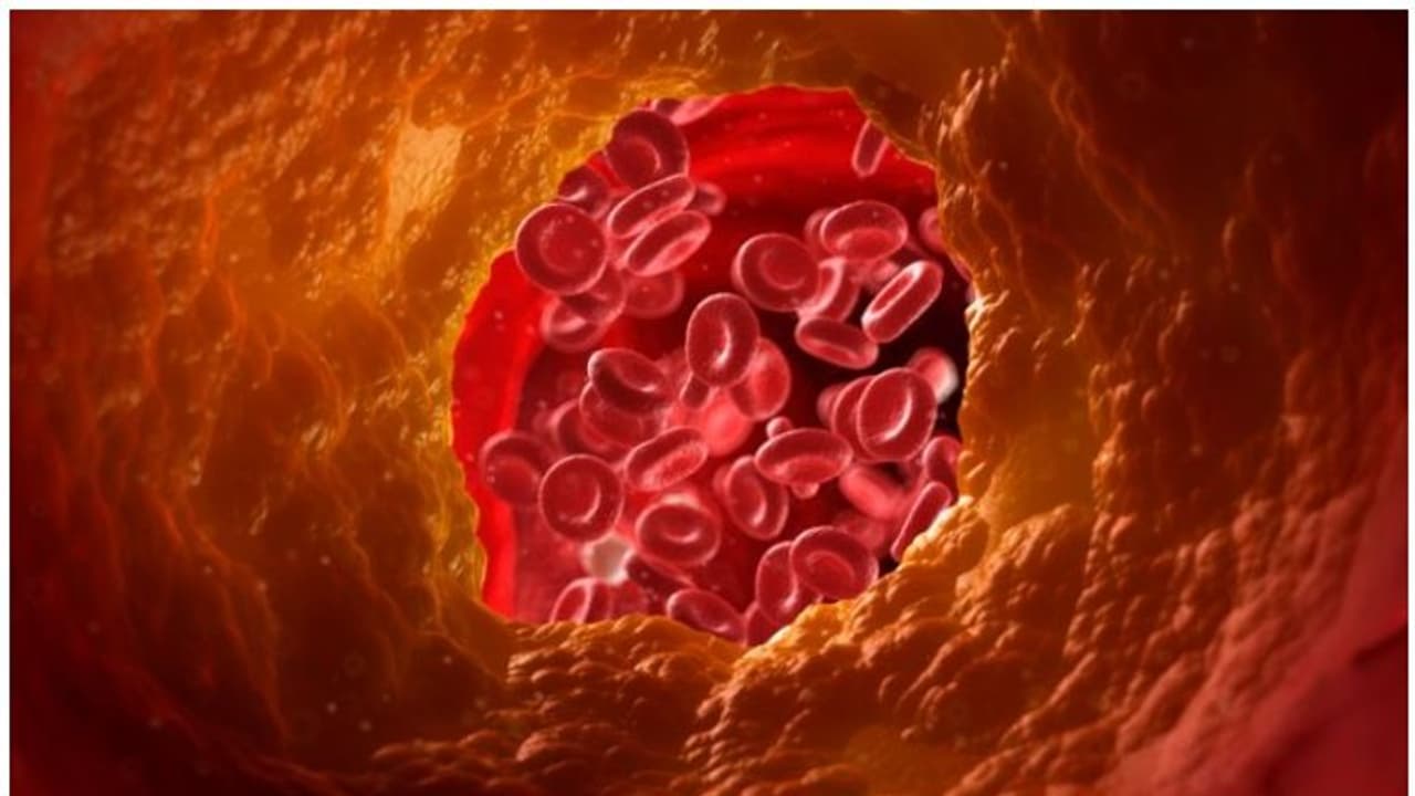 cholesterol cholesterol