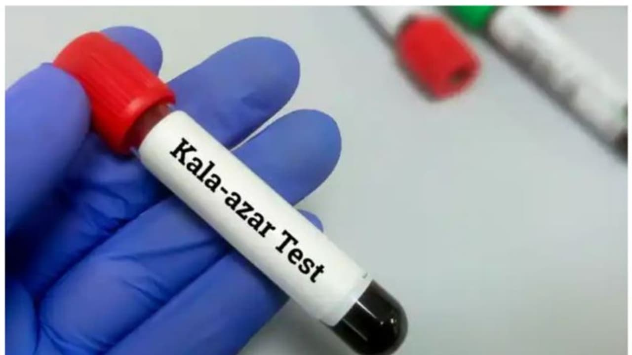 Kala Azar or Black fever Kala Azar or Black fever