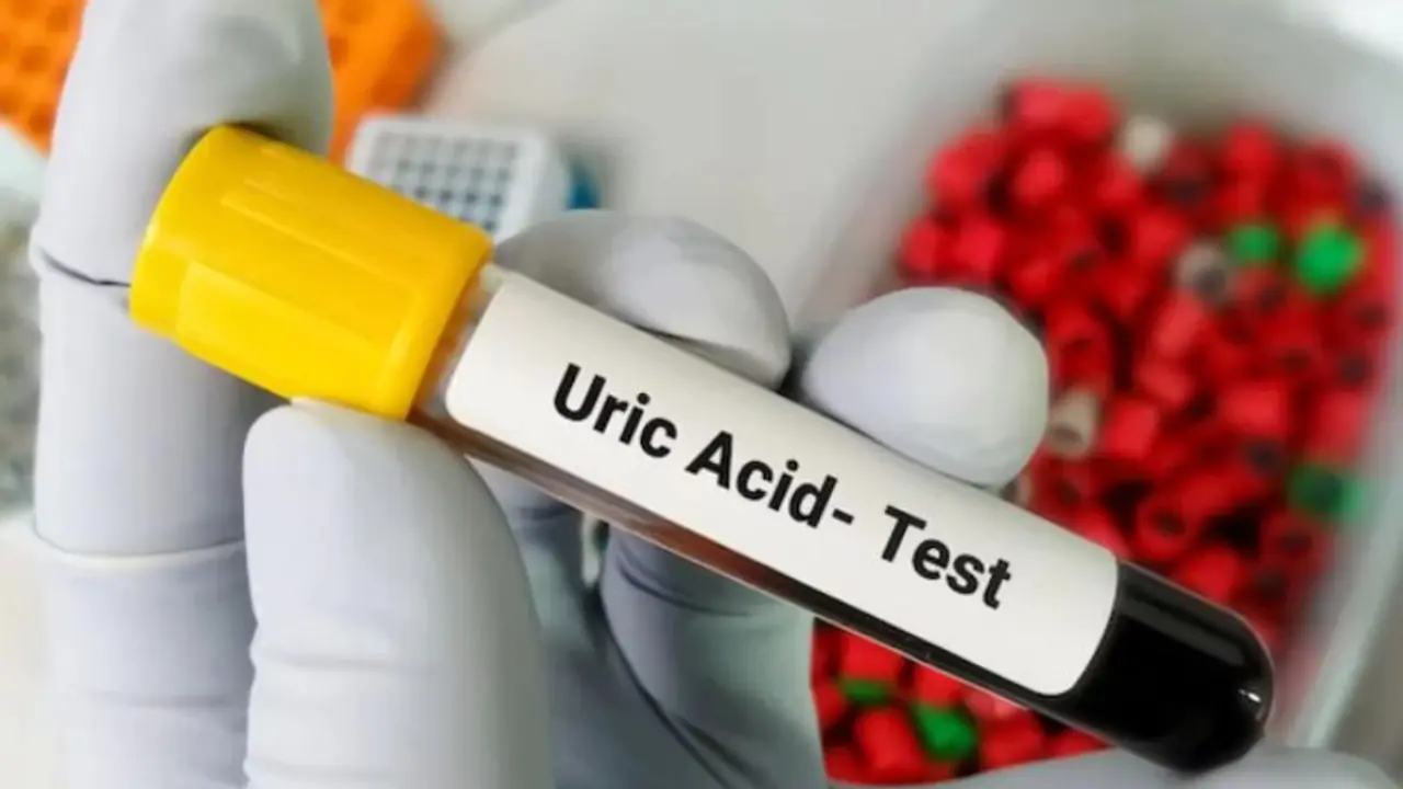 uric acid uric acid