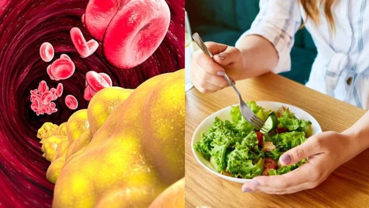 cholesterol cholesterol