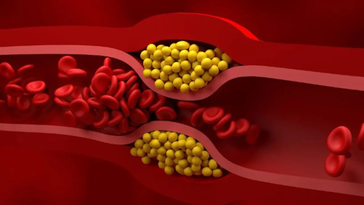 cholesterol cholesterol