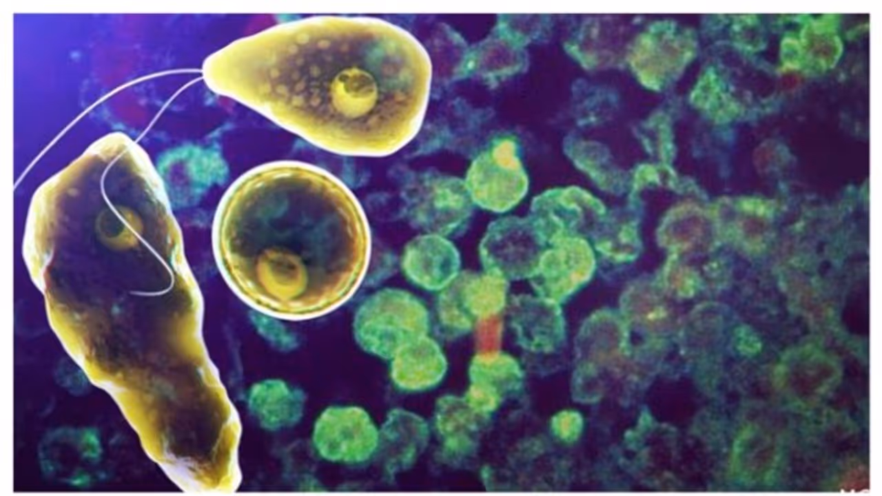 amoebic encephalitis