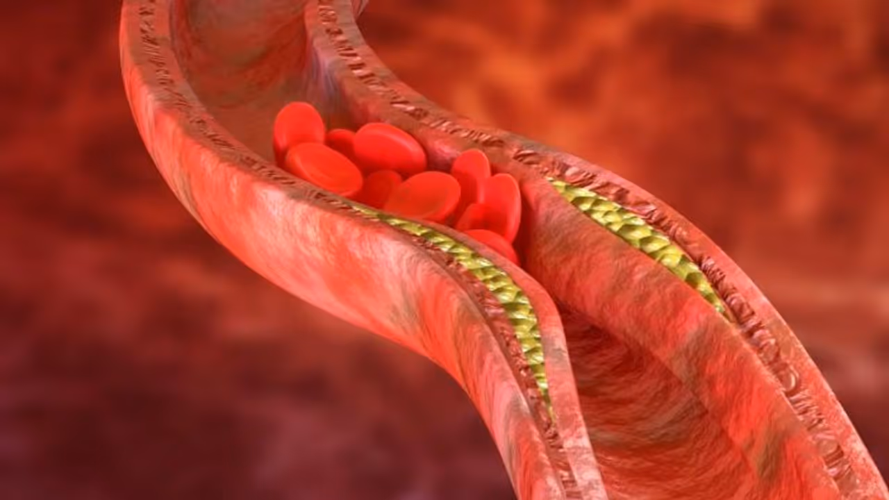 cholesterol cholesterol