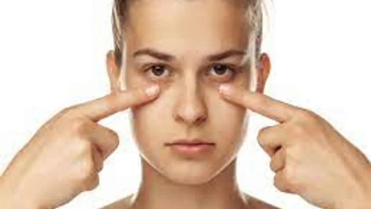 dark circles dark circles