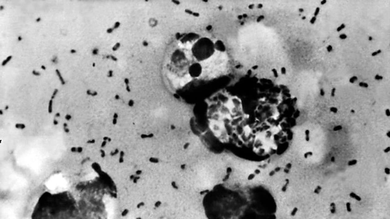 bubonic plague
