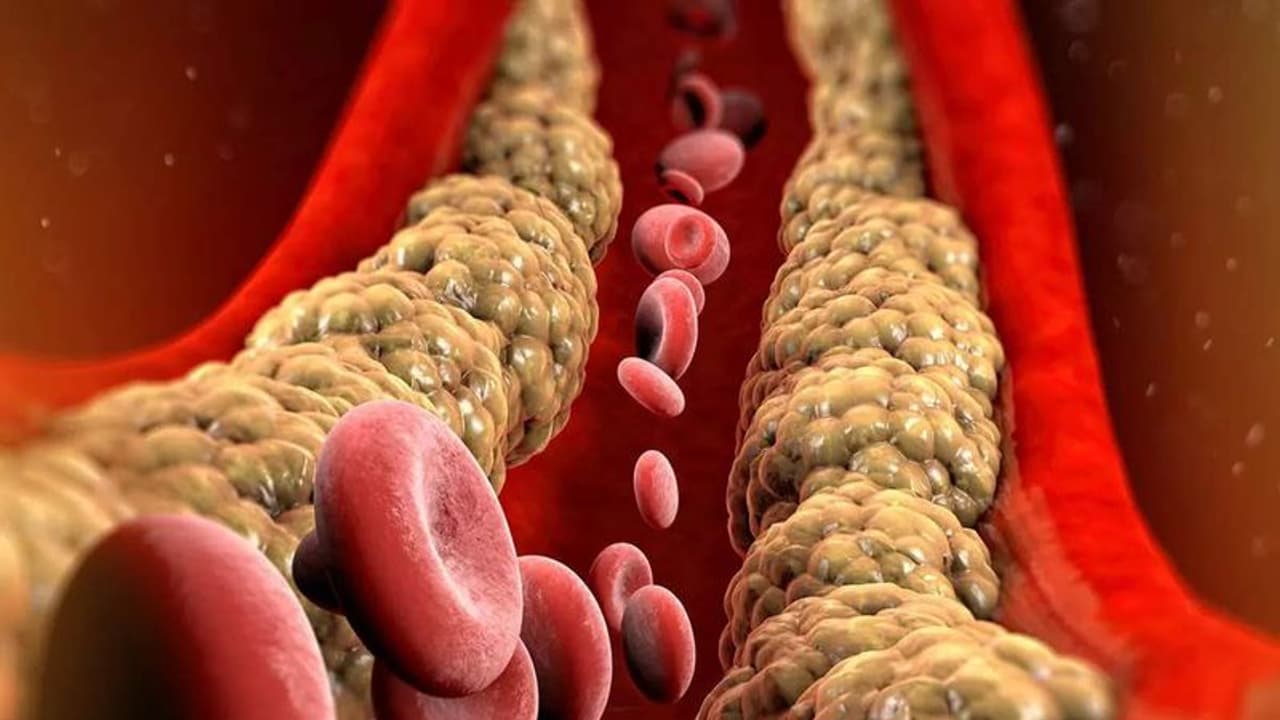 cholesterol cholesterol