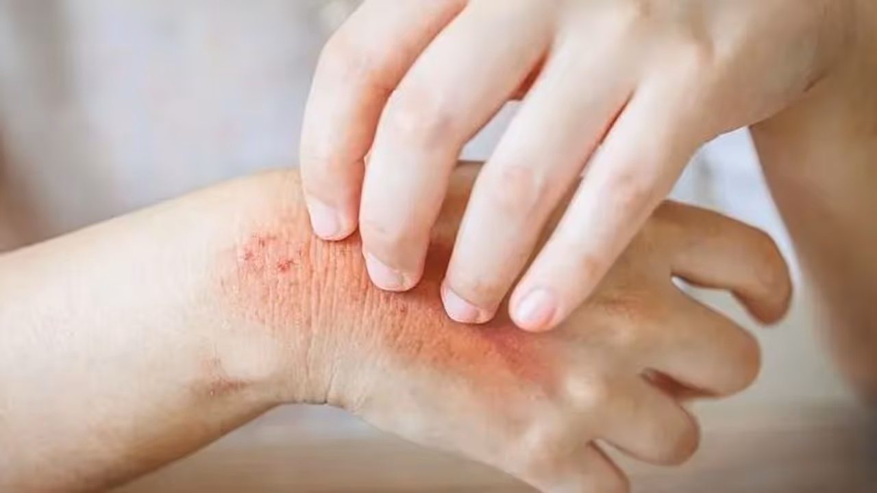 skin fungal infections skin fungal infections