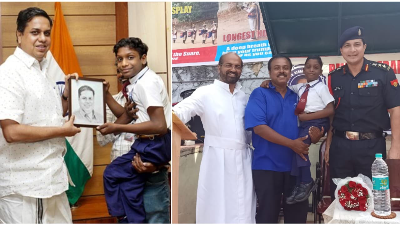 priyan meningocele patient