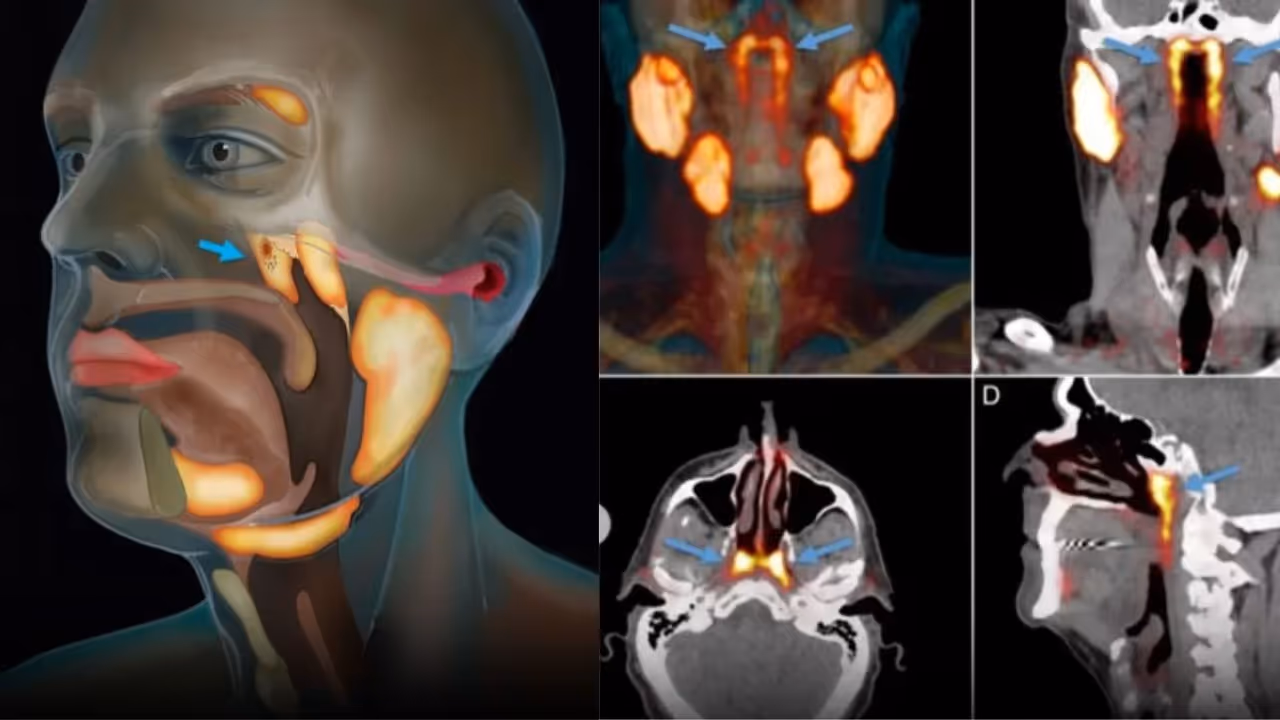 Cancer Treatment Cancer Treatment