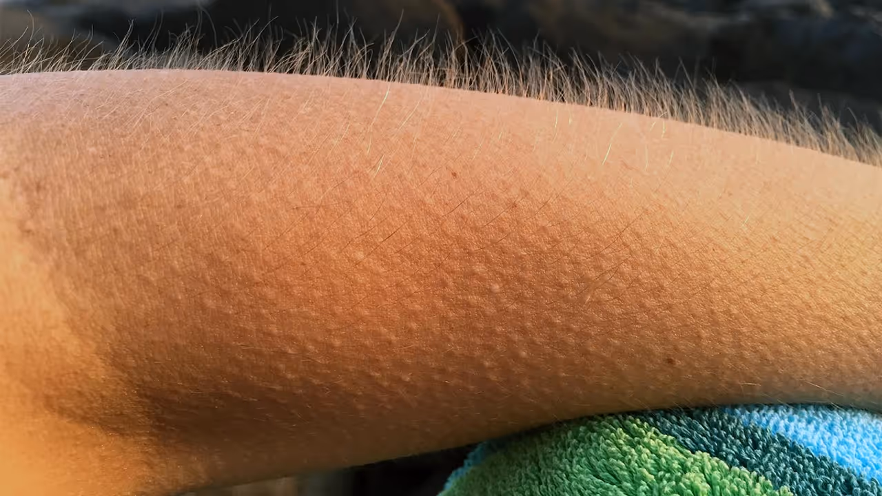 Goosebumps Goosebumps