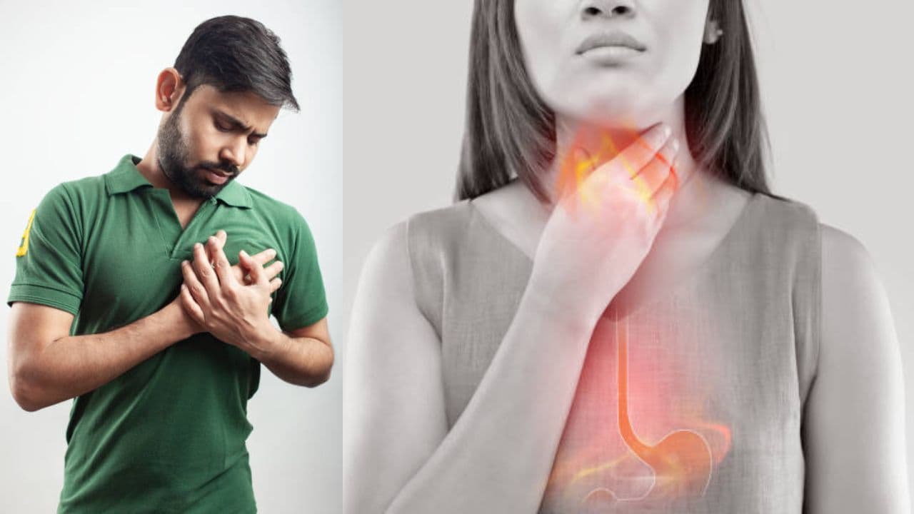 acidity or heart attack know its difference acidity or heart attack know its difference