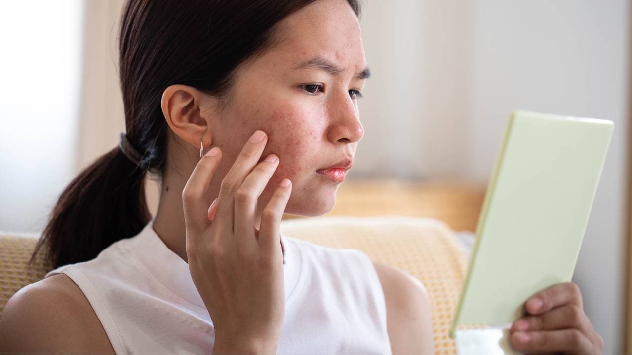 skin damage skin damage