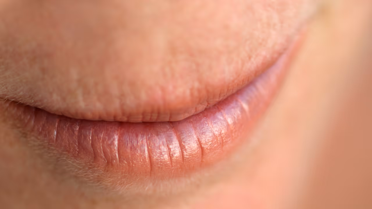 dry lips dry lips
