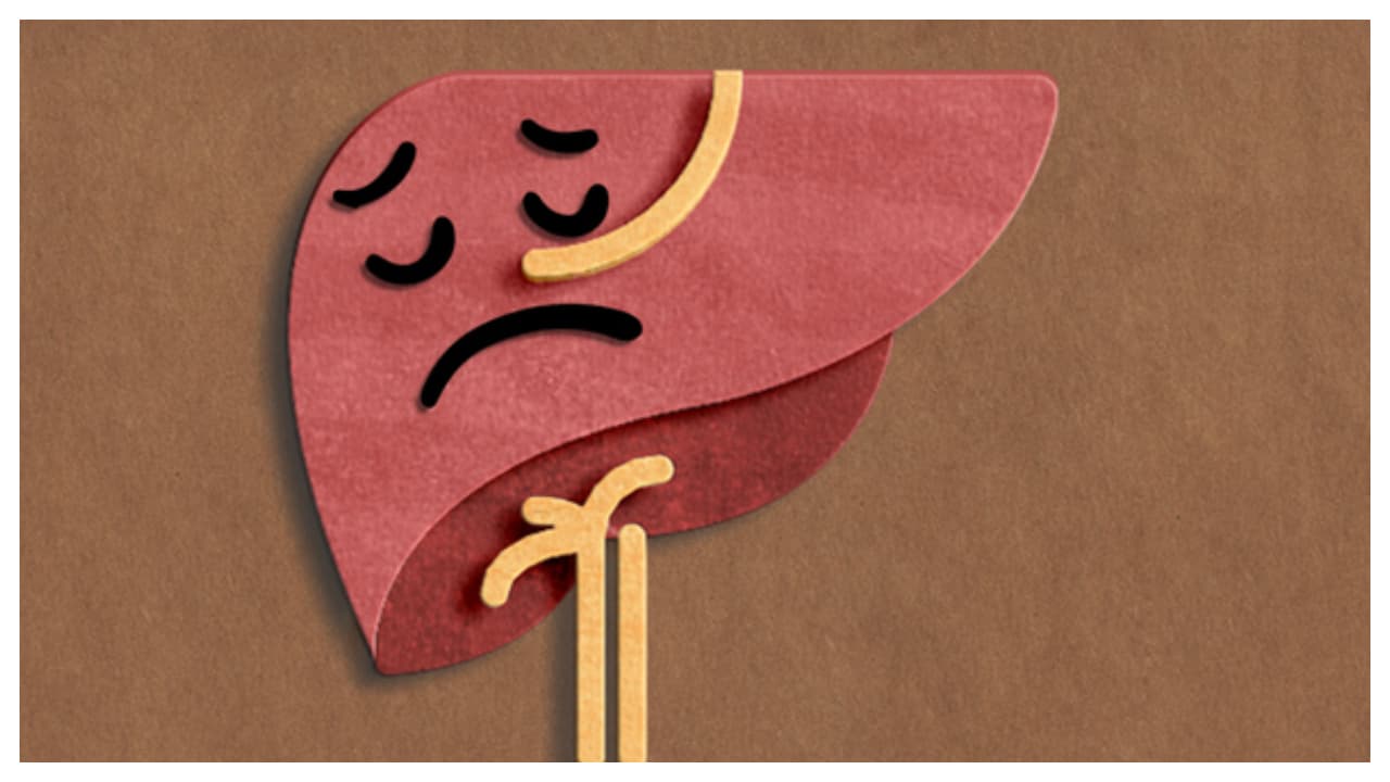 fatty liver fatty liver