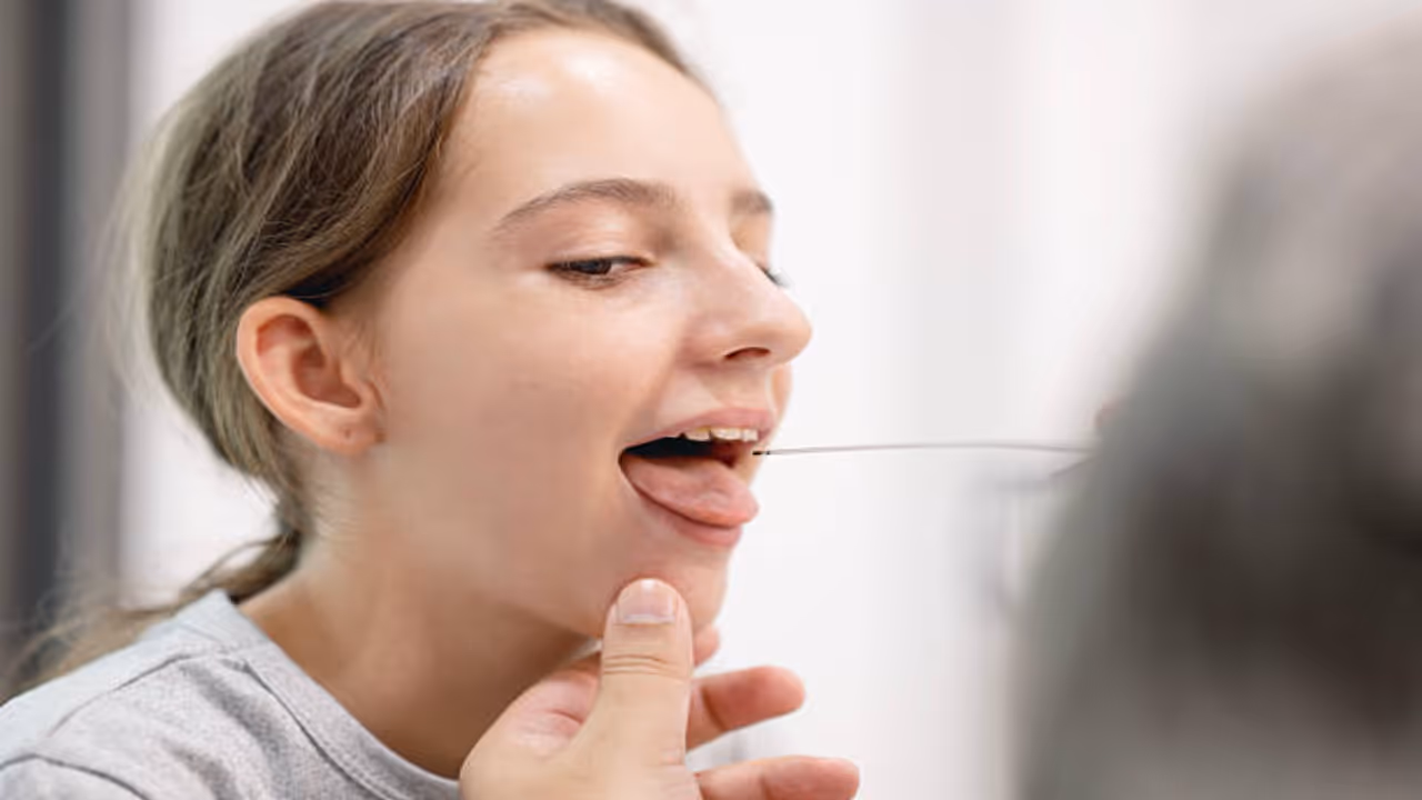 Why Do Mouth Ulcers Increase in Summer Causes and Prevention Tips Why Do Mouth Ulcers Increase in Summer Causes and Prevention Tips
