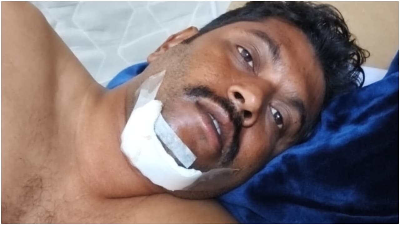 Malayali Driver Brutally Assaulted and Robbed in Saudi Arabia by Fake Passengers Malayali Driver Brutally Assaulted and Robbed in Saudi Arabia by Fake Passengers