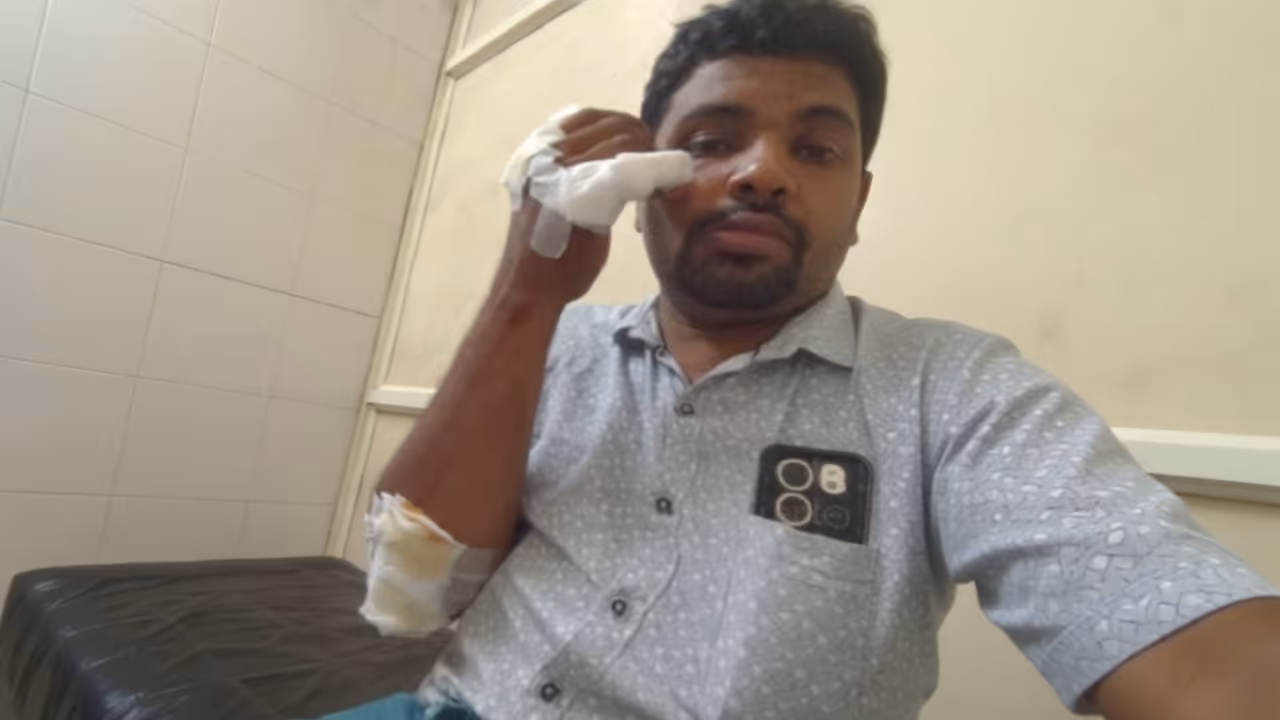 Kozhikode Couple Injured in Bike Accident Caused by Wild Boar Kozhikode Couple Injured in Bike Accident Caused by Wild Boar