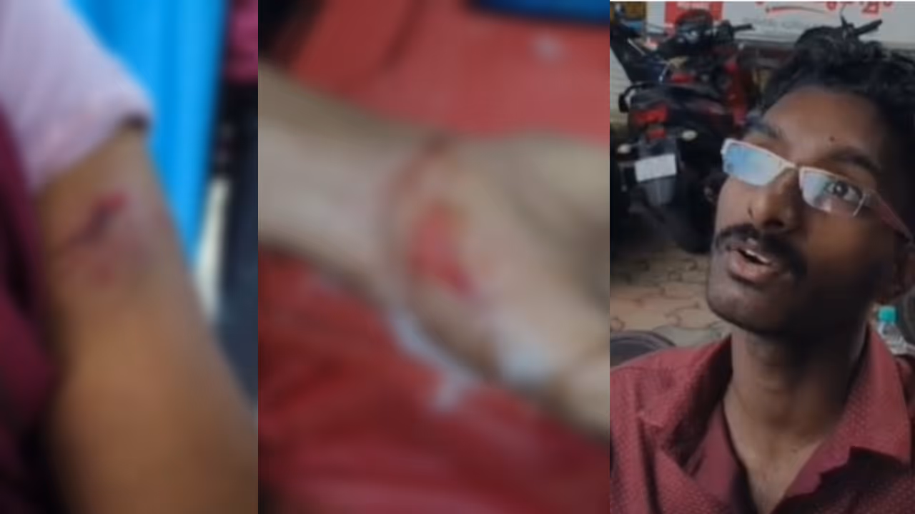 stray dog attack in pathanamthitta stray dog attack in pathanamthitta