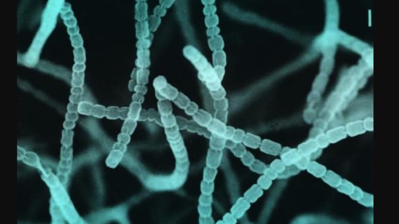 State microbe State microbe