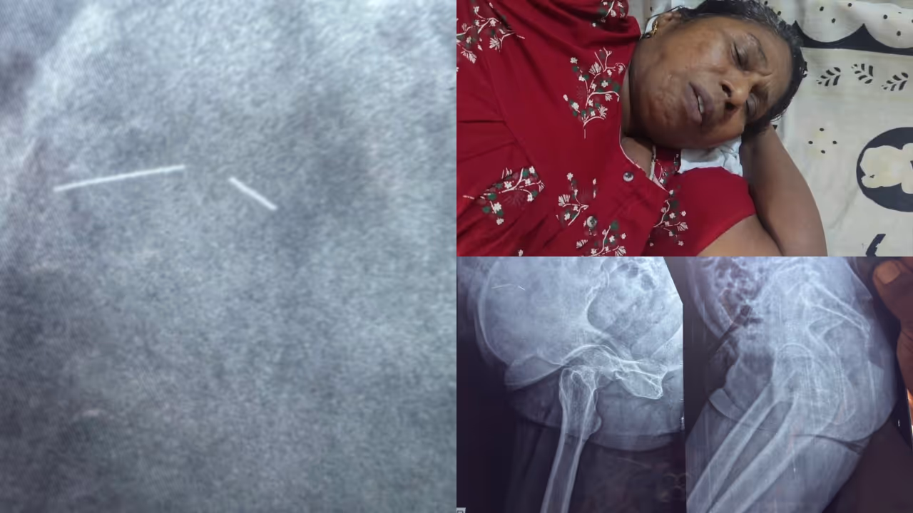Medical negligence Medical negligence