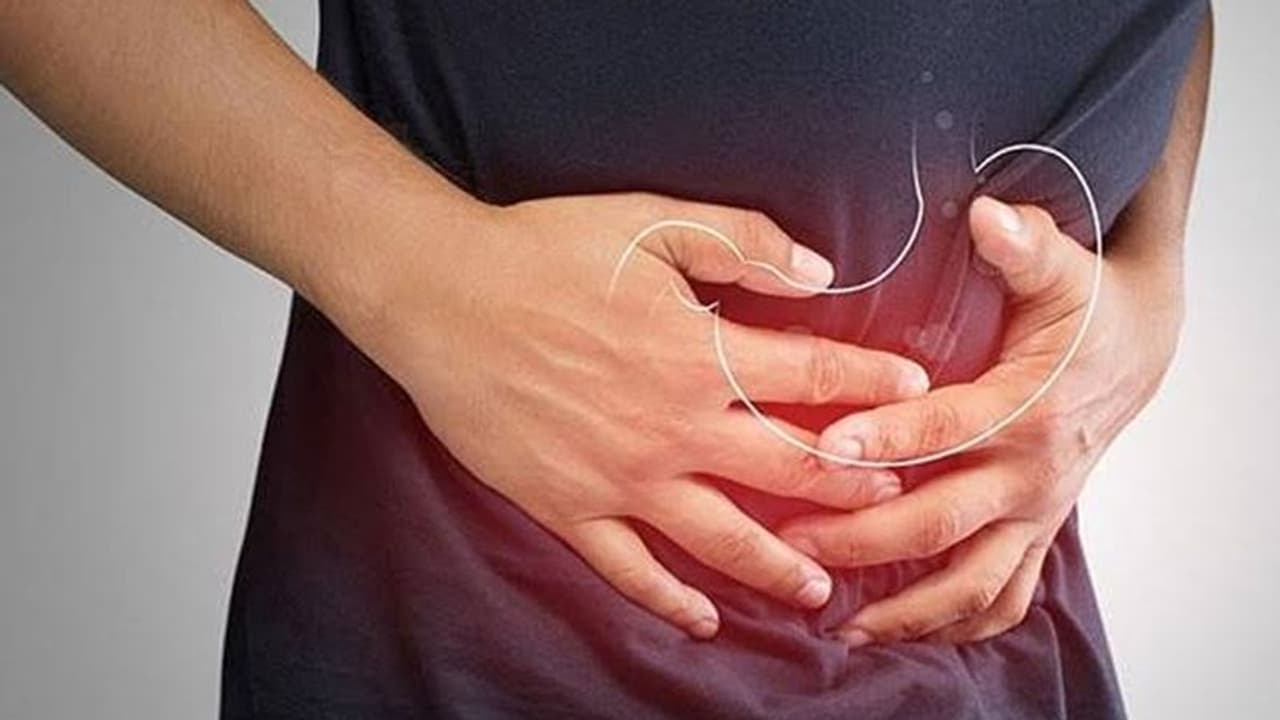 Colon Cancer Colon Cancer