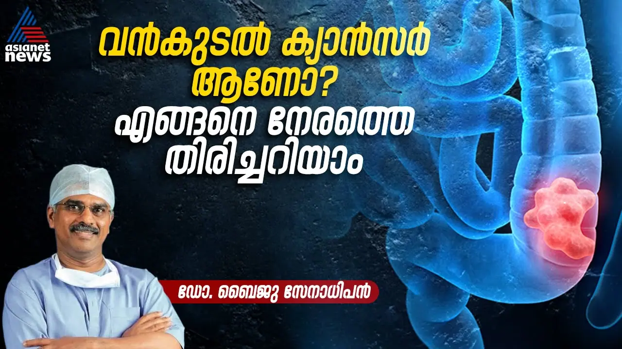 colon cancer colon cancer