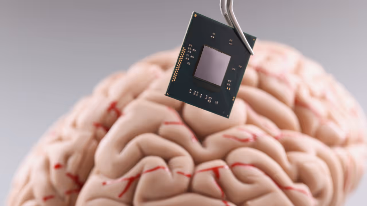 Brain implant Brain implant