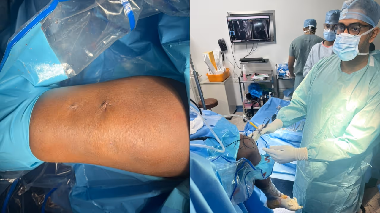 Nanoscopic meniscus surgery Nanoscopic meniscus surgery