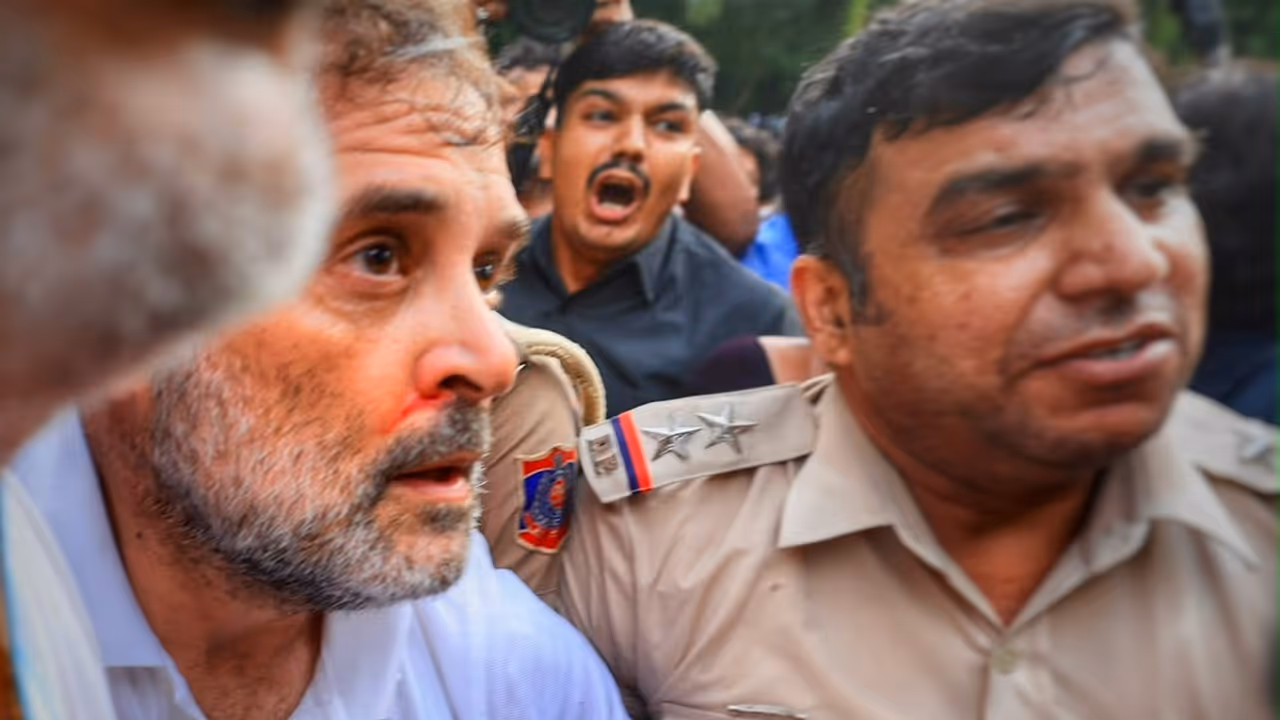 Rahul gandhi nose blood Rahul gandhi nose blood