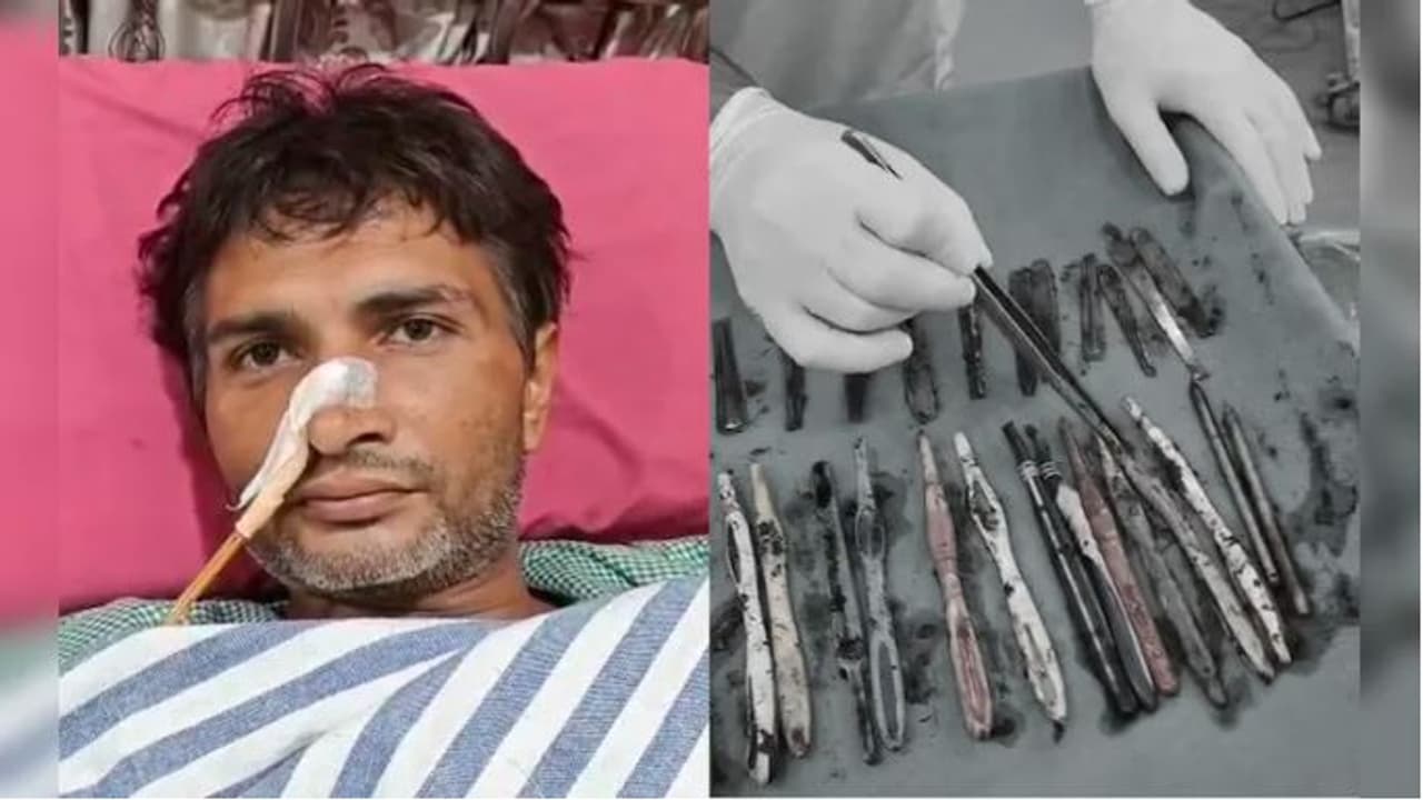 Man Swallows Spoons Man Swallows Spoons