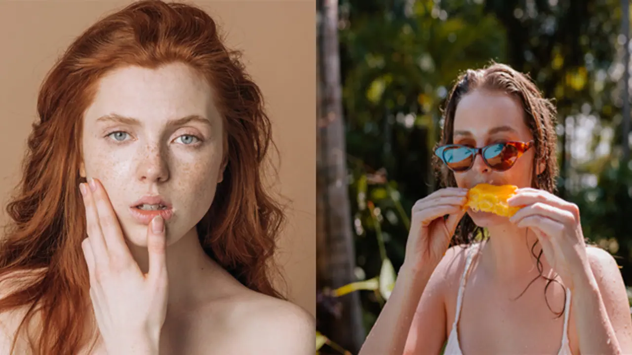 how to get rid of pimples after eating mangoes