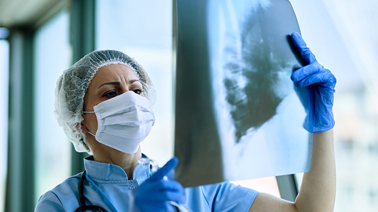 lung damage due to covid 19 lung damage due to covid 19