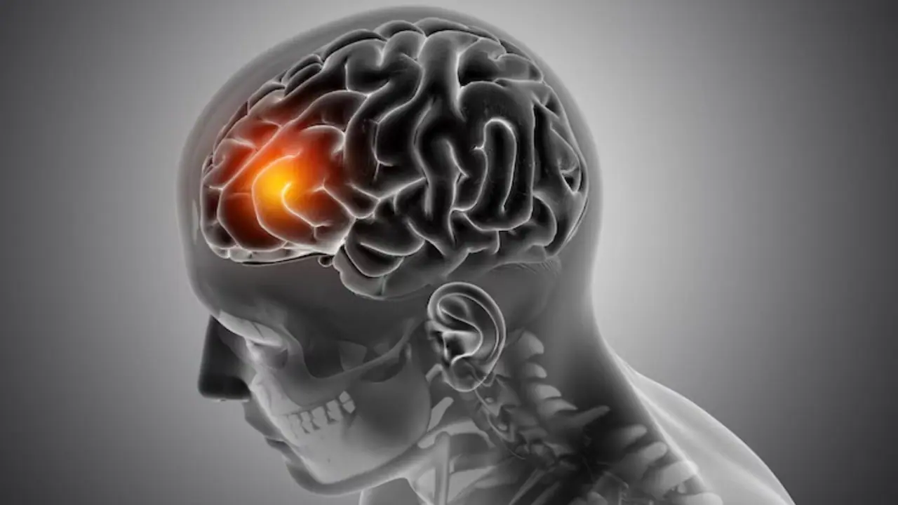 What are the main causes of brain tumor in adults and children