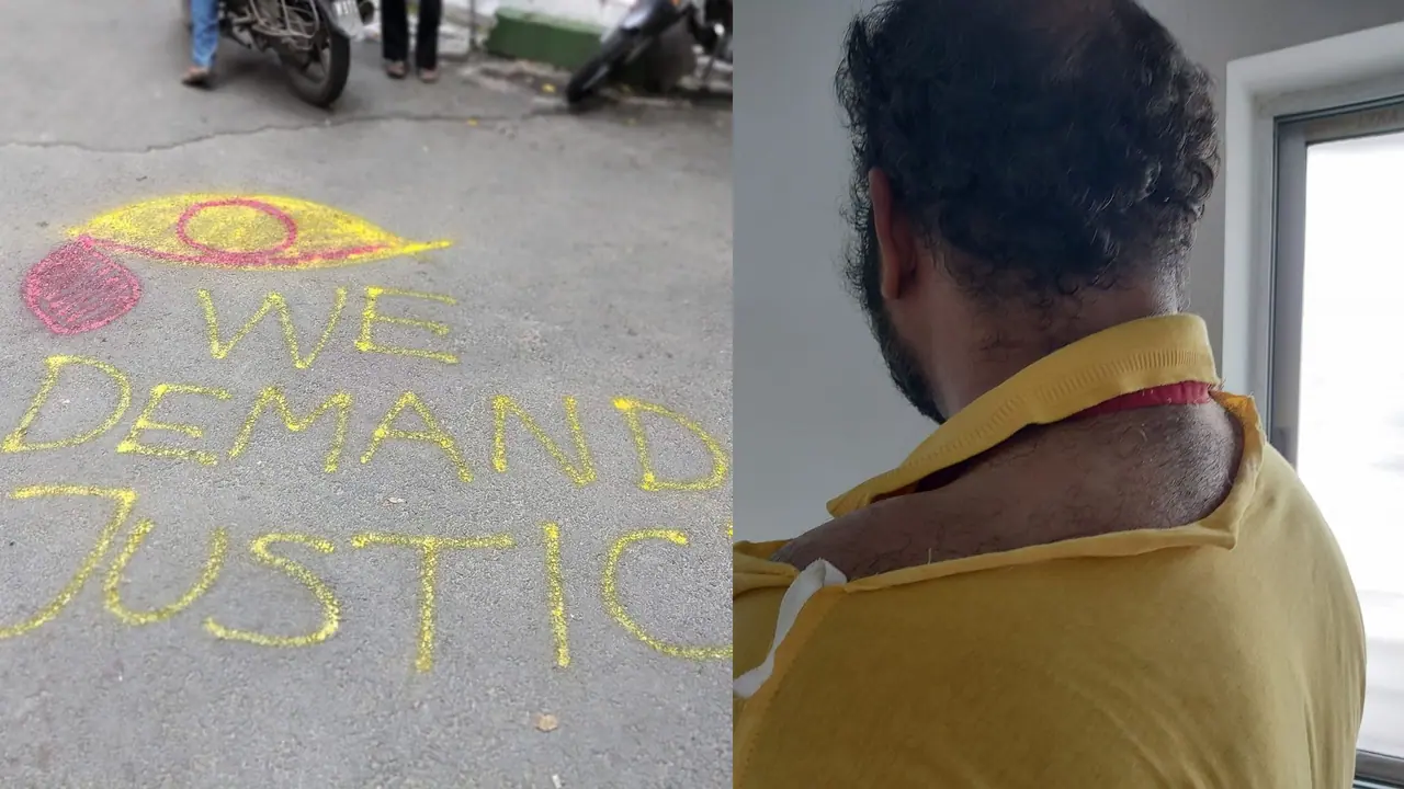 Attack on Protestor Attack on Protestor