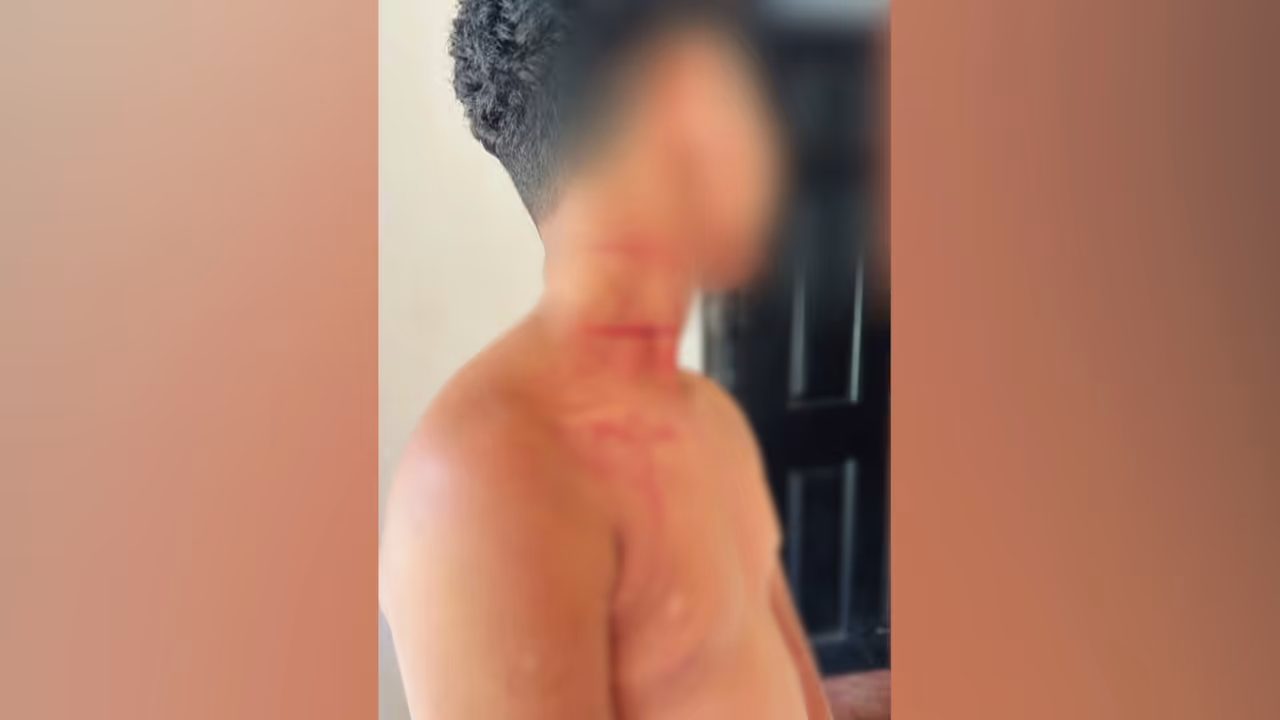 Adivasi student beaten brutally Adivasi student beaten brutally