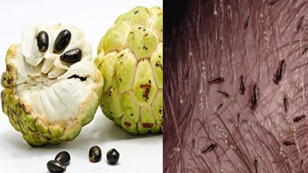 ow to get rid of Lice by custard apple seed