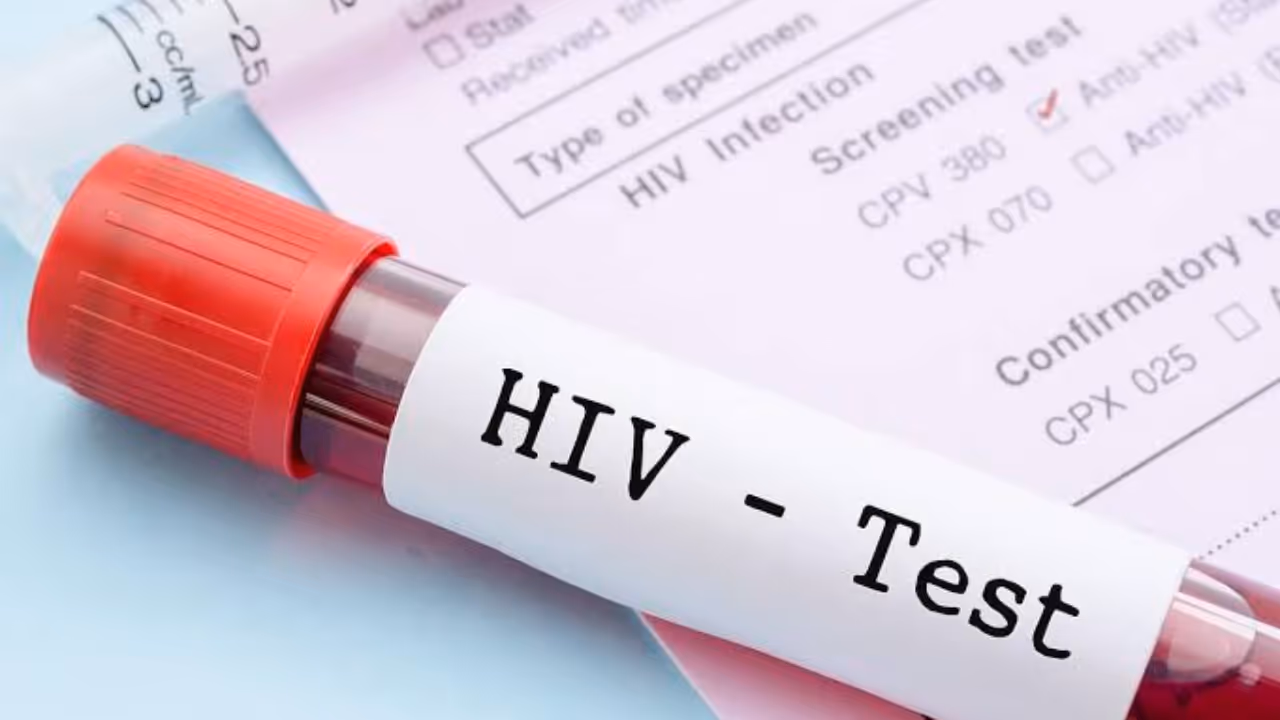 HIV Test HIV Test