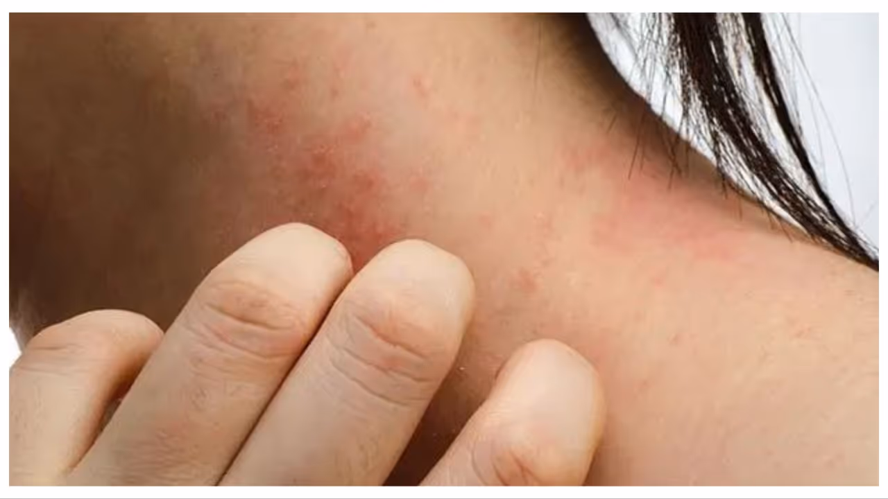 skin rashes skin rashes