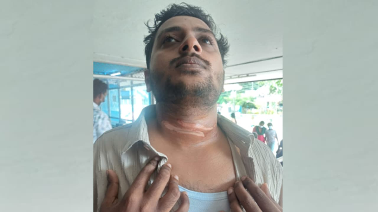 cable accident cable accident