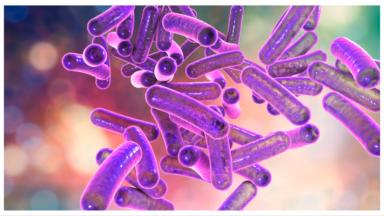 shigella shigella